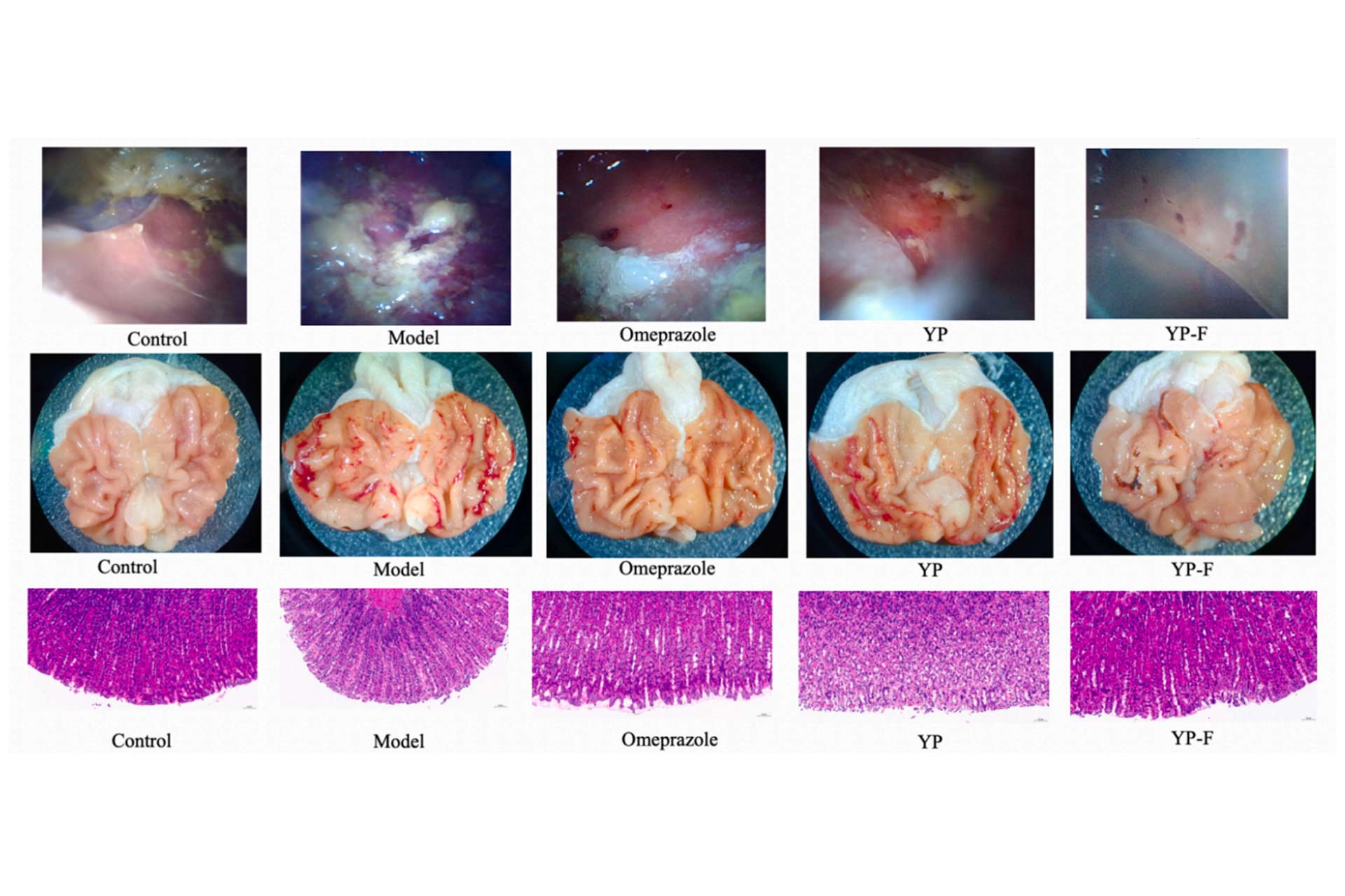 the-gastroscopy-results.jpg the-gastroscopy-results.jpg
