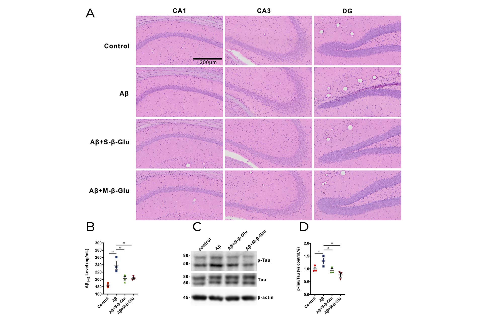 (A)-H&E-staining-of-mouse-hippocampus-and-(B)(C)(D)-Western-blot-analysis-of-tau-and-p-tau-protein-with-significant-differences.jpg (A)-H&E-staining-of-mouse-hippocampus-and-(B)(C)(D)-Western-blot-analysis-of-tau-and-p-tau-protein-with-significant-differences.jpg