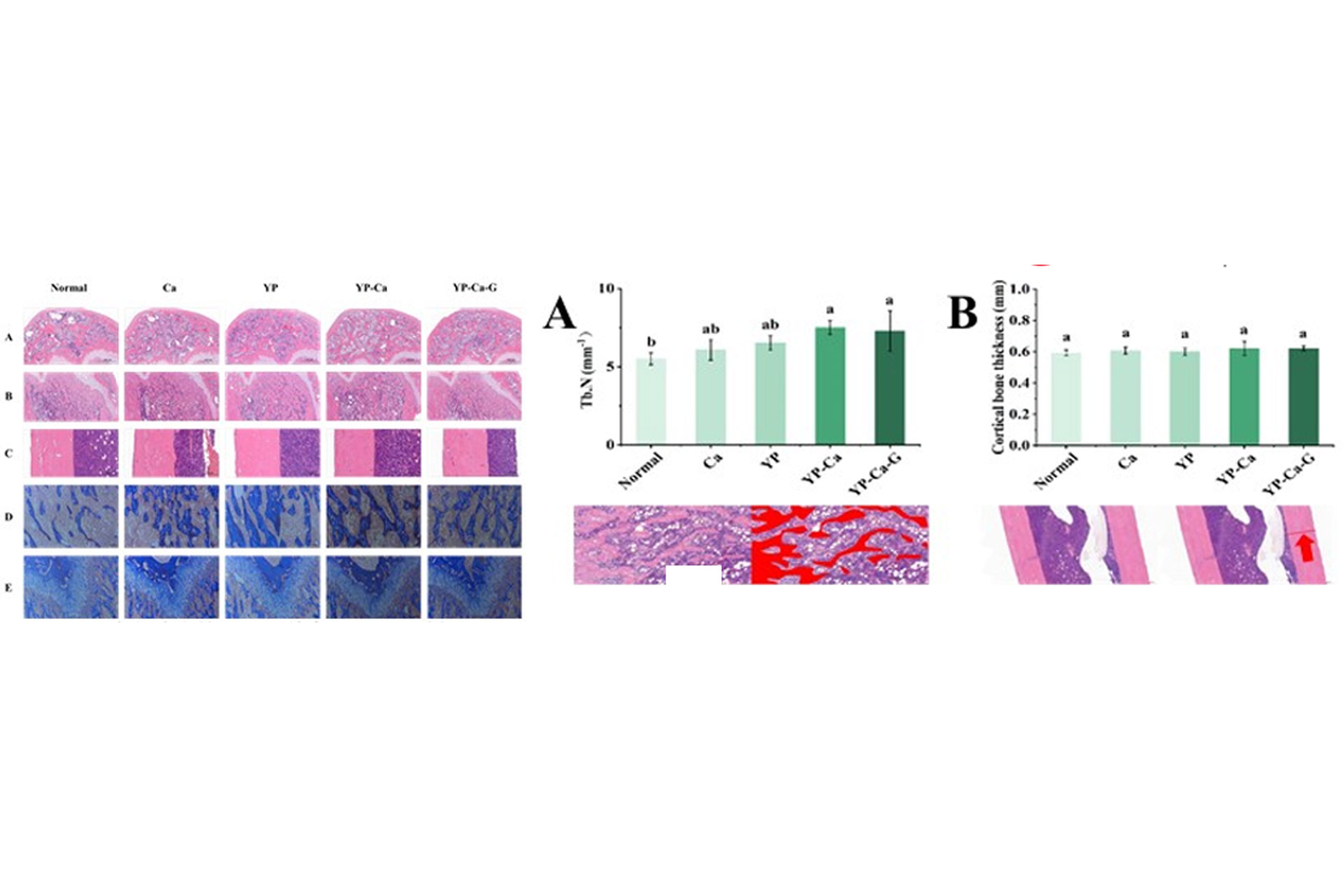 Effects-of-yeast-protein-supplementation-on-rat-trabecular-and-cortical-bone-thickness.jpg Effects-of-yeast-protein-supplementation-on-rat-trabecular-and-cortical-bone-thickness.jpg