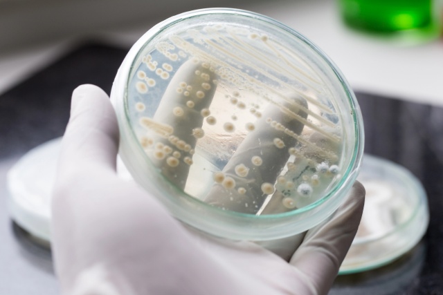 Angel Active Yeast and Biocatalysis