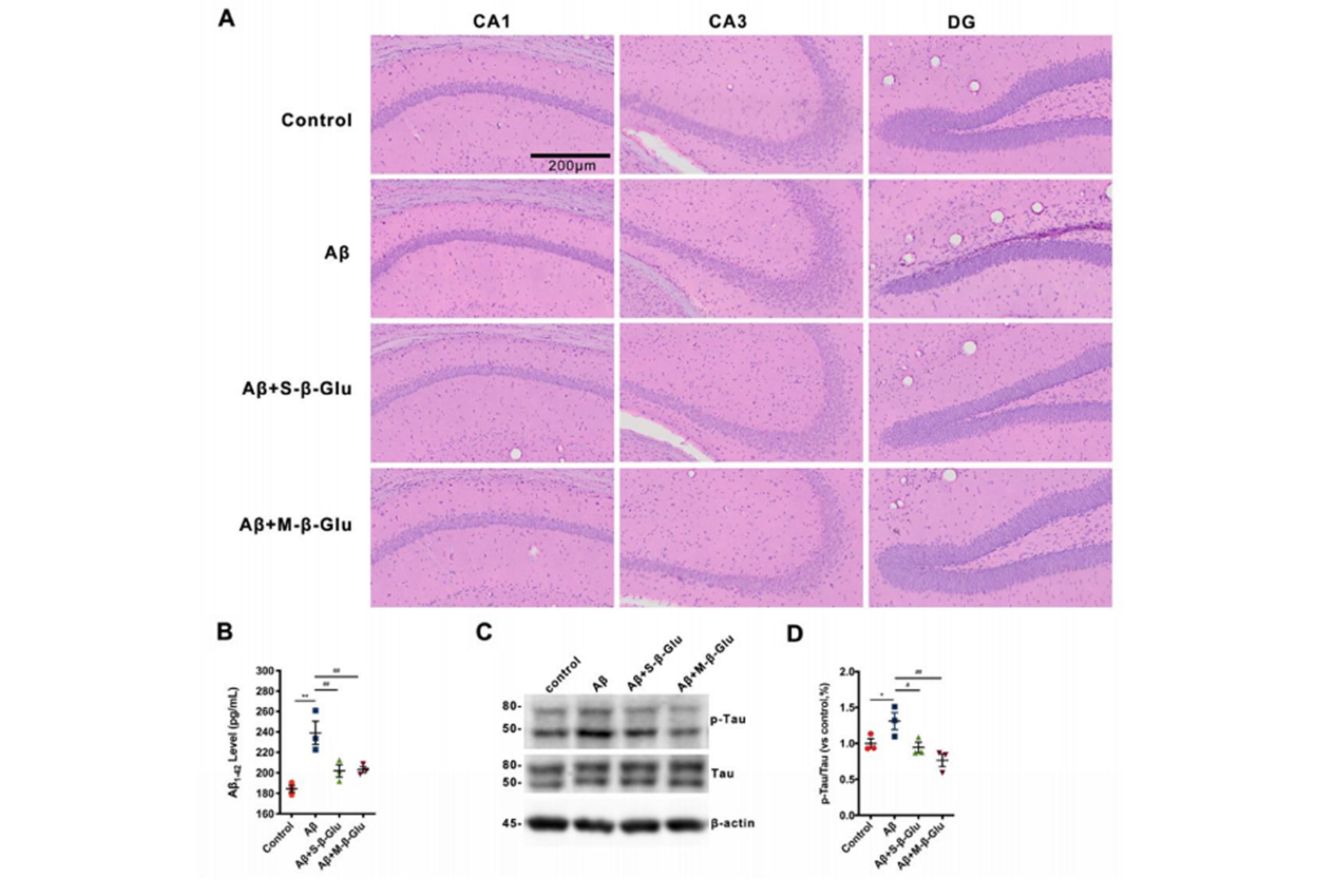 (A)-H&E-staining-of-the-mouse-hippocampus,-and-(B)-(C)-(D)-WB-analysis-of-tau-and-p-tau-proteins-and-their-significant-differences.jpg (A)-H&E-staining-of-the-mouse-hippocampus,-and-(B)-(C)-(D)-WB-analysis-of-tau-and-p-tau-proteins-and-their-significant-differences.jpg