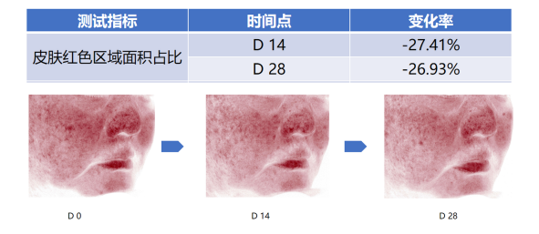 含0.3%酵母β-葡聚糖验证乳液使用前后观察 含0.3%酵母β-葡聚糖验证乳液使用前后观察